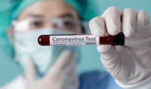 Ilustrasi tes virus corona atau covid 19 6